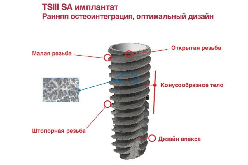 импланты osstem Серия TS